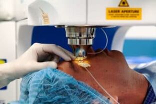 Chirurgie cu vedere laser