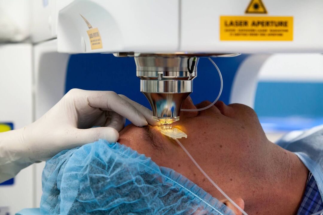 chirurgie cu laser pentru restabilirea vederii